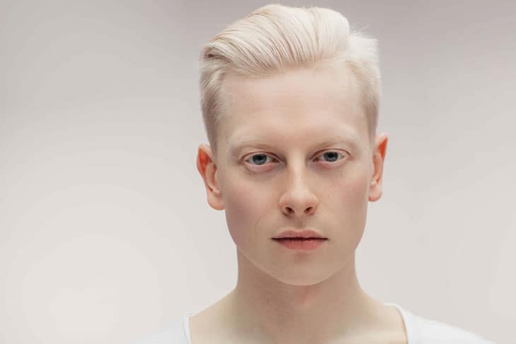 albinismus und augen
