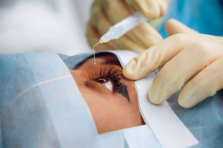 implantierbare kontaktlinse